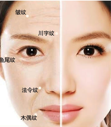 馨漫之舍 祛痘修复精华乳——打造水润健康美肌