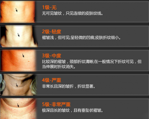 准备好了吗，深圳联合丽格带你揭秘嗨体的真面目