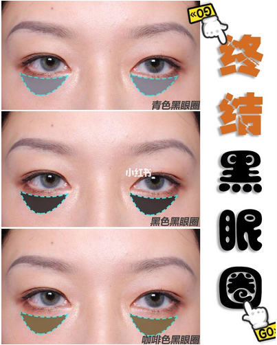 黑眼圈的类型有哪些？成因以及解决方法是什么？