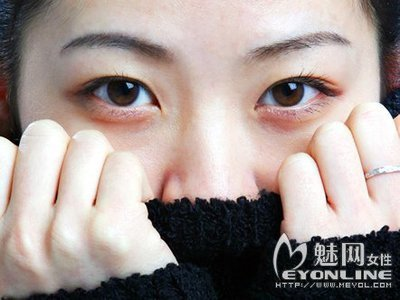 黑眼圈的类型有哪些？成因以及解决方法是什么？