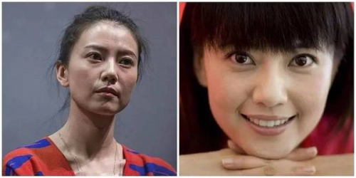 黑眼圈的类型有哪些？成因以及解决方法是什么？