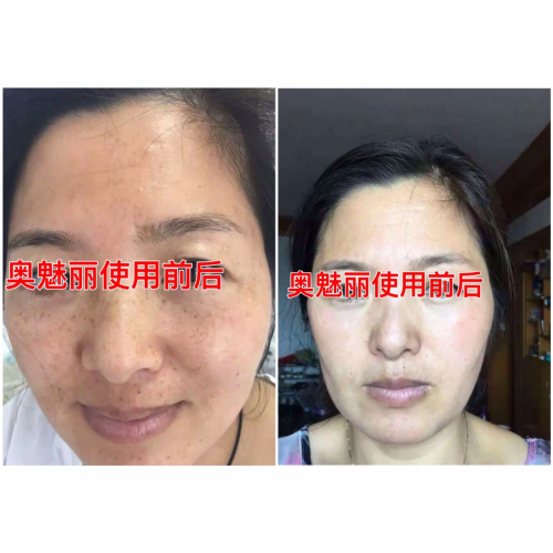 【疯传】逆袭女神!奥魅丽给我带来的巨变!