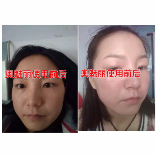 【疯传】逆袭女神!奥魅丽给我带来的巨变!