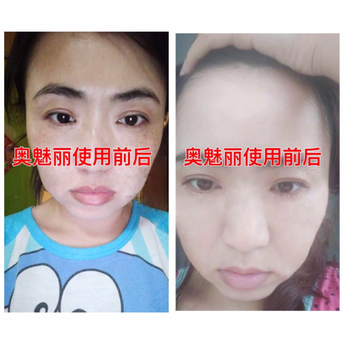 【疯传】逆袭女神!奥魅丽给我带来的巨变!