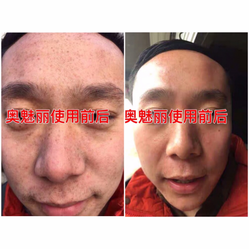 【疯传】逆袭女神!奥魅丽给我带来的巨变!