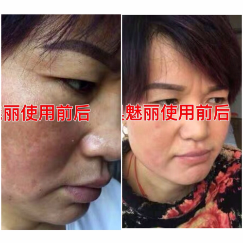 【疯传】逆袭女神!奥魅丽给我带来的巨变!