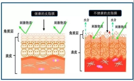 调查发现，100%的女性觉得自己是“敏感肌”！？资生堂提出“敏感反复肌肤”概念