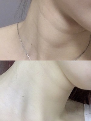再贵的护肤品，也不如一台美容仪效果来得明显，Ms.W女王你真的了解吗？