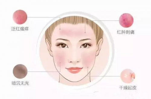 【械】字号舒润修护精华——修敷特SOS特护小飞机