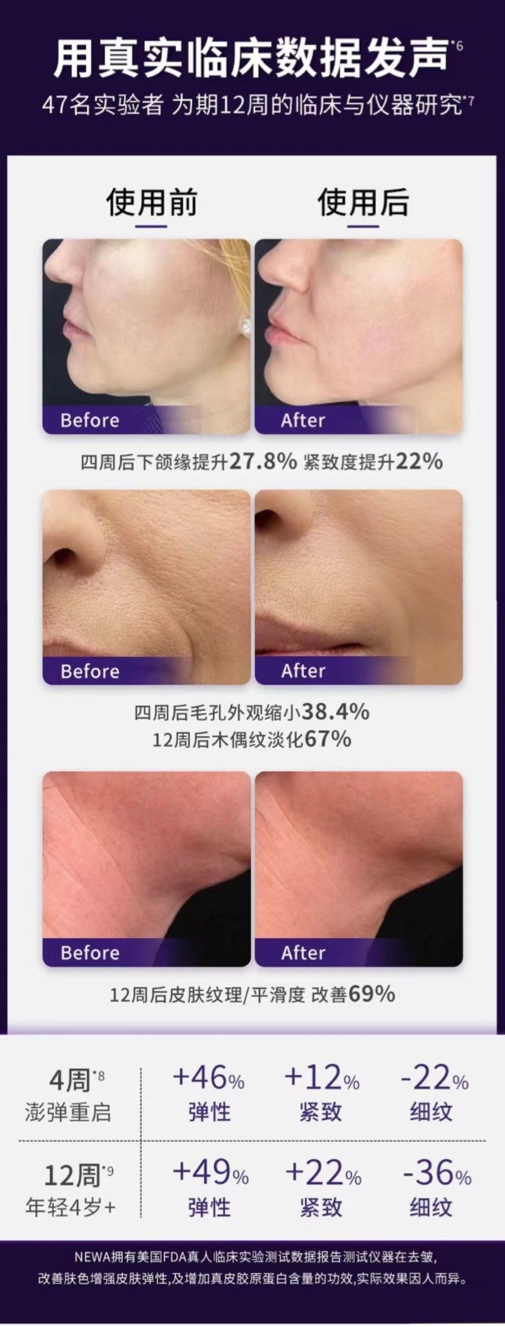 “Z时代”的美容护肤新主张，NEWA家用美容仪火爆全网