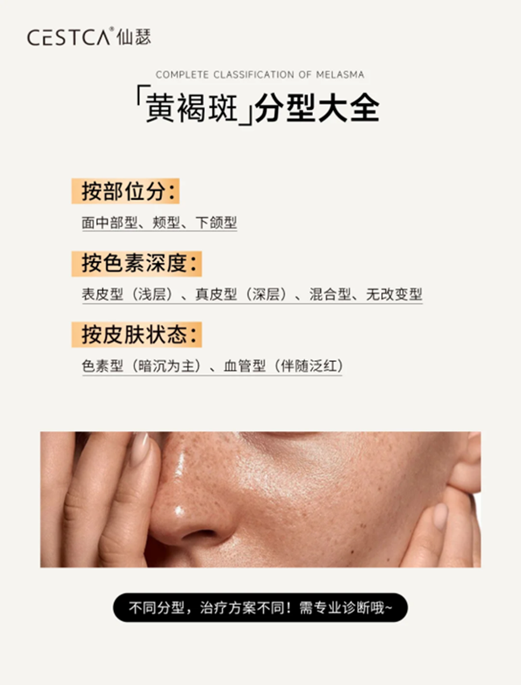 应对黄褐斑:仙瑟传明酸精华液给出新答案